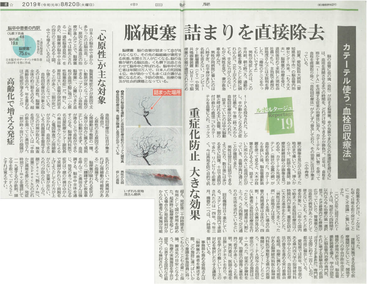 中日新聞掲載 カテーテルを使う「血栓回収療法」