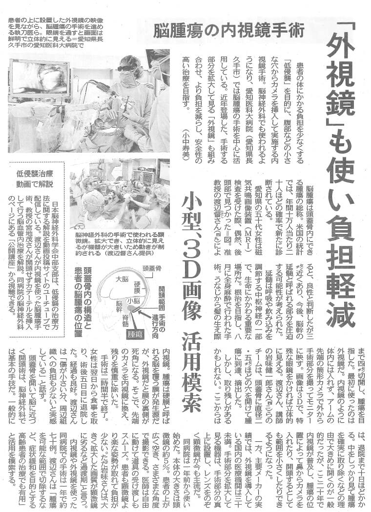 中日新聞掲載 脳腫瘍の内視鏡手術